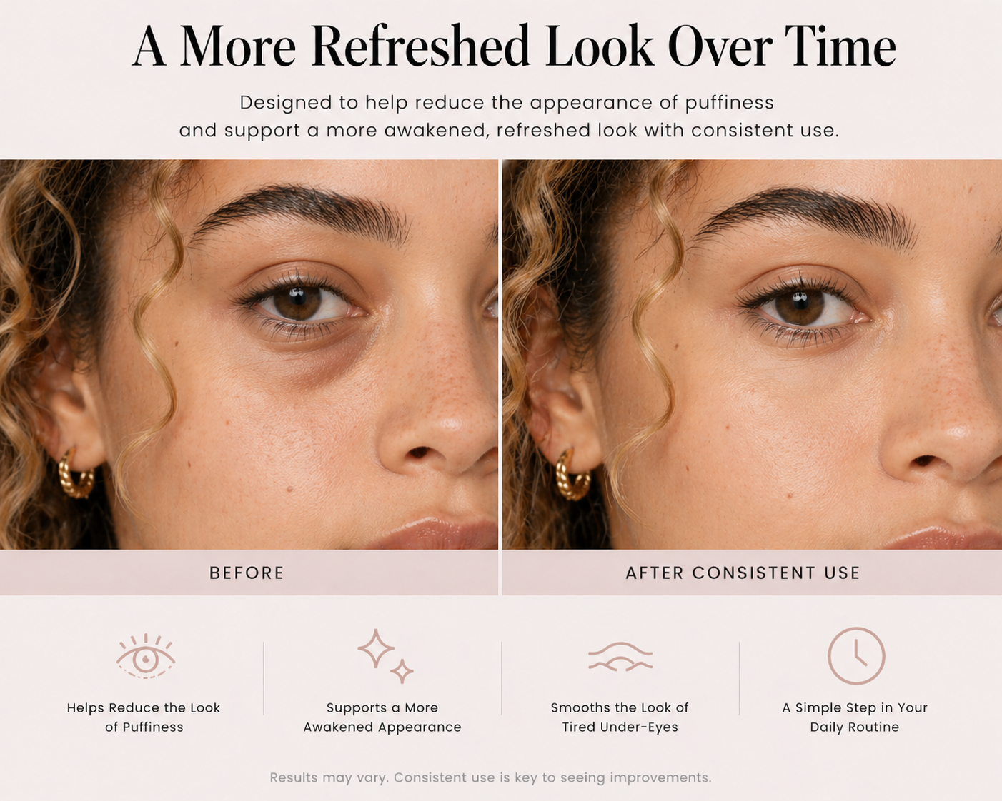 The Under-Eye Sculptor